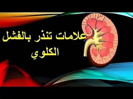 اعراض الفشل الكلوي - عرض مشهور ومهم يدل على الفشل الكلوى 5130 1