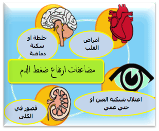 علاج ارتفاع ضغط الدم , اسباب وطرق علاج ارتفاع ضغط الدم