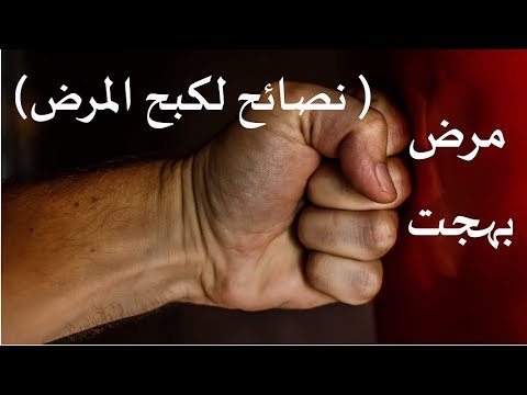 مرض بهجت - مرض مناعة ذاتي على اسم مكتشفه الدكتور بهجت 3192 1