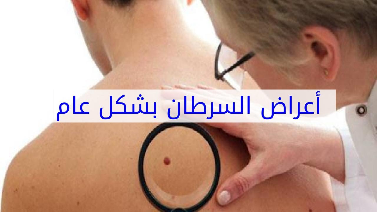 اعراض مرض السرطان , علامات الاصابة بمرض السرطان