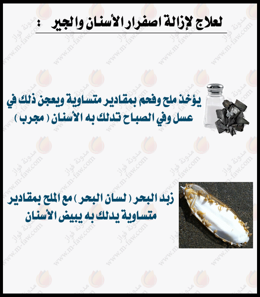 علاج وجع الاسنان , الم الاسنان وكيفية علاجه