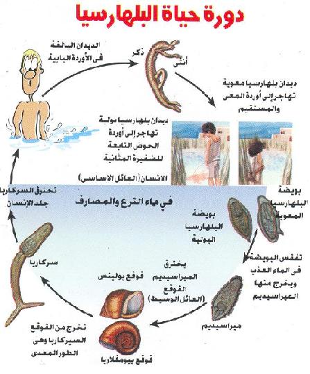 مرض البلهارسيا , اسباب وطرق علاج مرض البلهارسيا