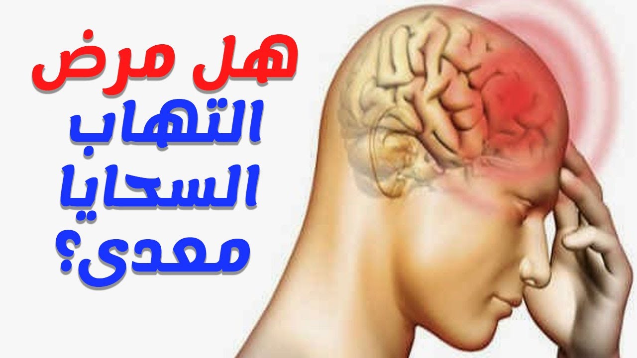 مرض السحايا , اعراض وعلاج مرض السحايا